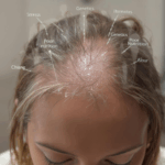 découvrez les raisons possibles pour lesquelles vos cheveux ne poussent pas comme vous le souhaitez. cet article explore les facteurs génétiques, nutritionnels et environnementaux qui peuvent influencer la croissance des cheveux, ainsi que des conseils pour favoriser leur santé et leur épanouissement.